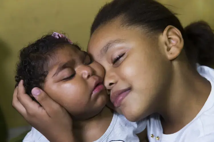 Eduardia, 9, holds her sister Valentina at their home in Duque de Caxias, a suburb of Rio de Janeiro in southeastern Brazil. Valentina's mother was pregnant when she became infected with the Zika virus and her daughter was born with microcephaly—a congenital malformation with smaller than normal head size for age and sex as well as other profound birth defects. Brazil has confirmed far more malformations of the brain in babies born to mothers who were infected with Zika than any other country. After she gave birth to Valentina, Eduardia elected to have a tubal ligation so she could not become pregnant again. Image by Mark Hoffman. Brazil, 2017.