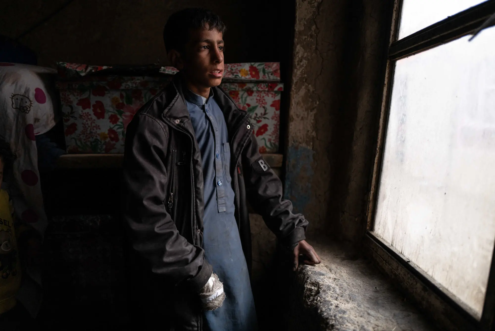 A young boy with bandaged hands looks out a window