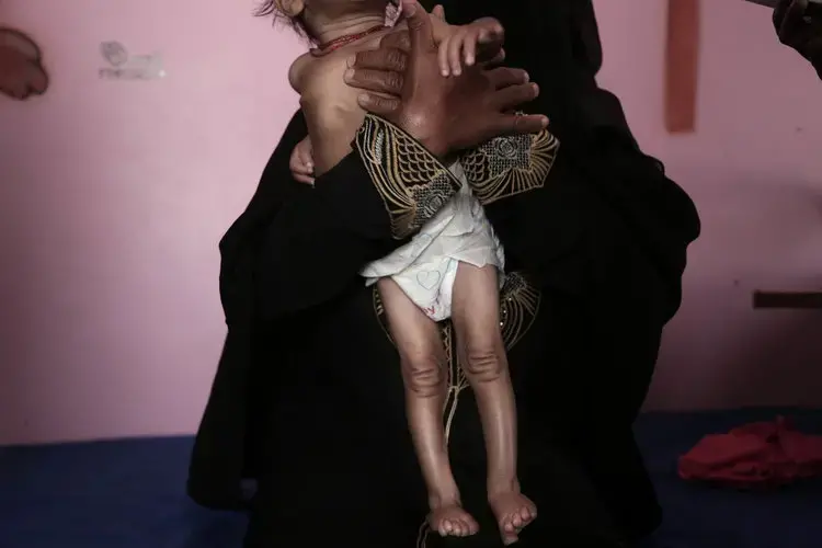 Mothers hold their children suffering from malnutrition in Yemen. Image by Nariman El-Mofty. Yemen, 2018.